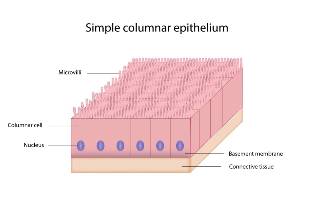 Плоскоклітинна метаплазія як виглядають клітини