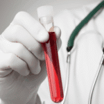 Чому густа кров небезпечна для життя